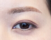 症例写真。高須クリニックで治療された方の症例をご紹介します。