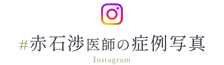 ＃赤石渉医師の症例写真/Instagram