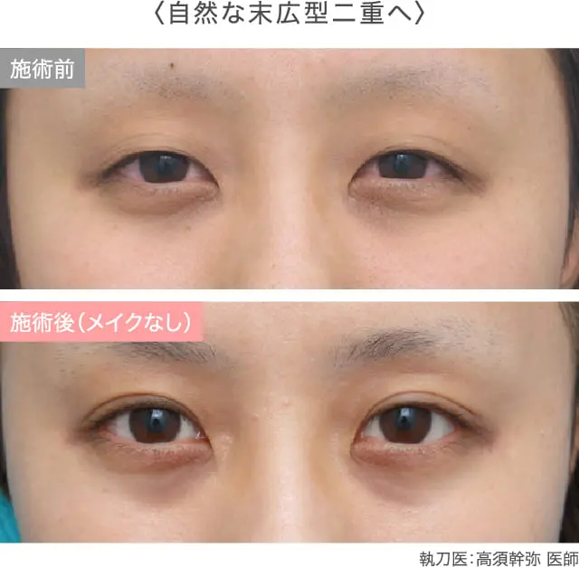 症例紹介画像