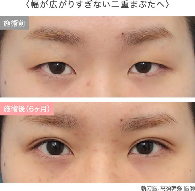 症例紹介画像