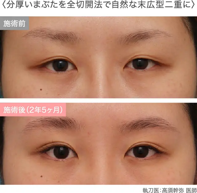 症例紹介画像