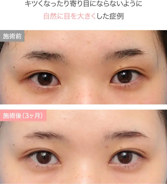 症例紹介画像