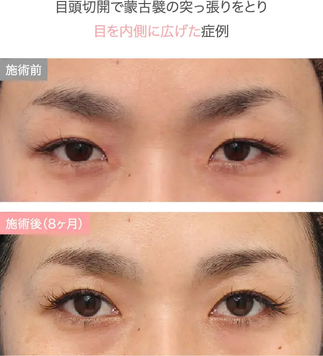 症例紹介画像