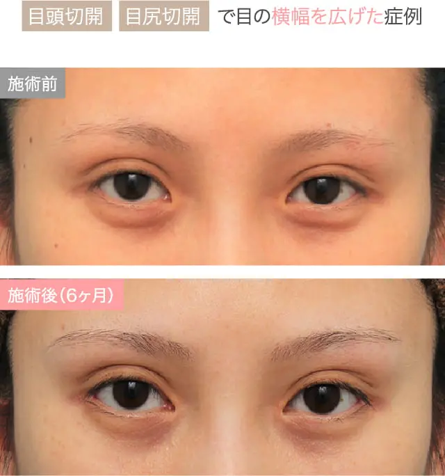 症例紹介画像