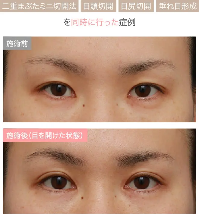症例紹介画像