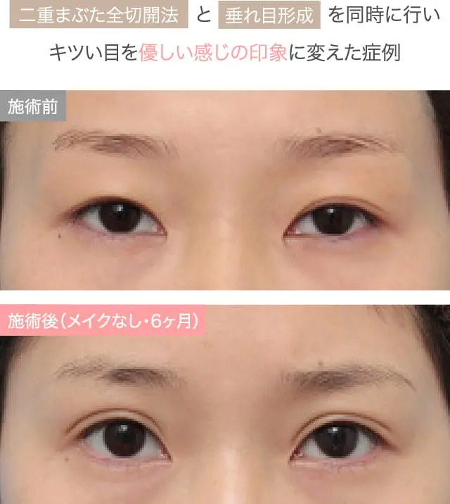 症例紹介画像