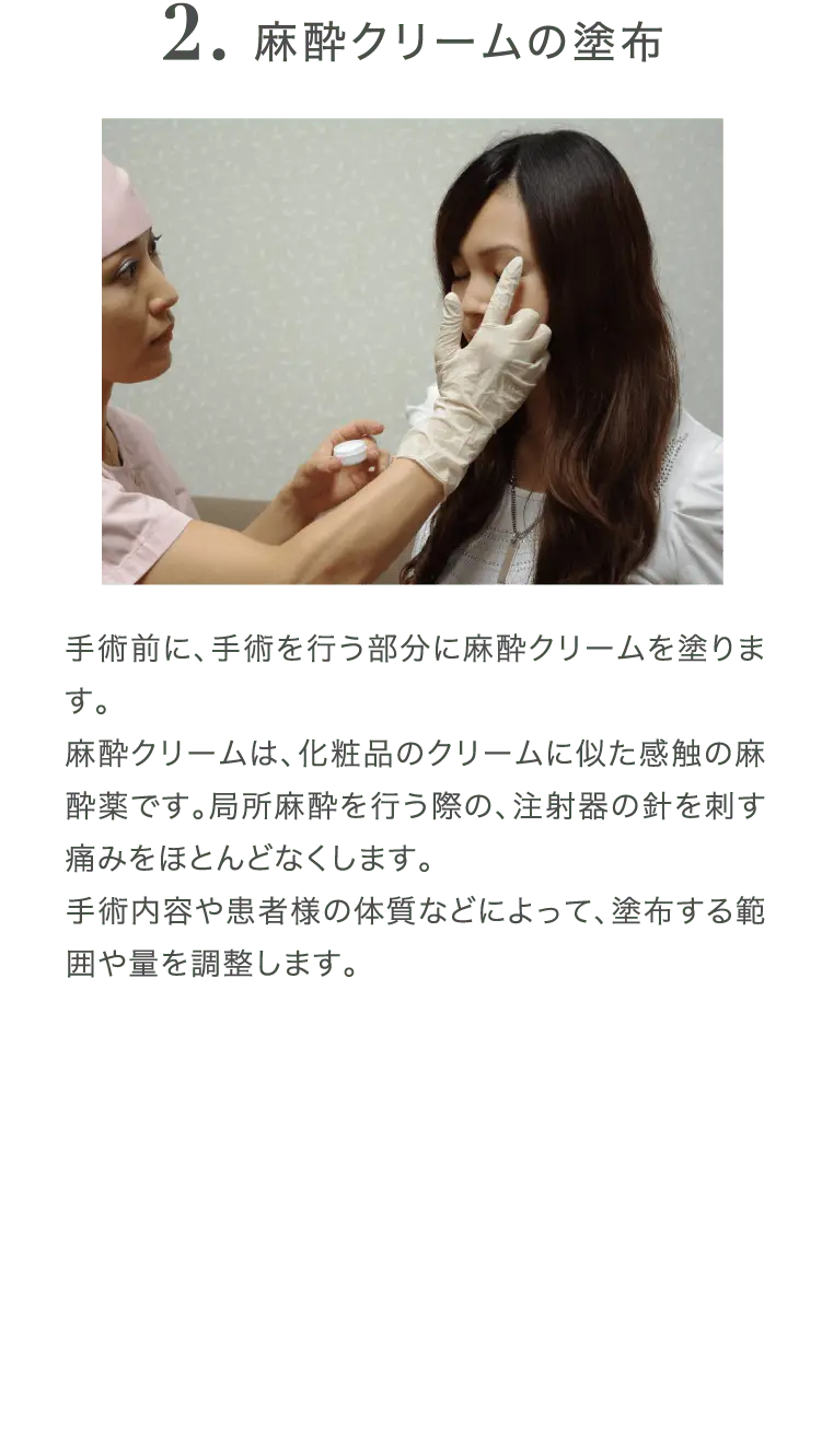 麻酔クリームの塗布の様子
