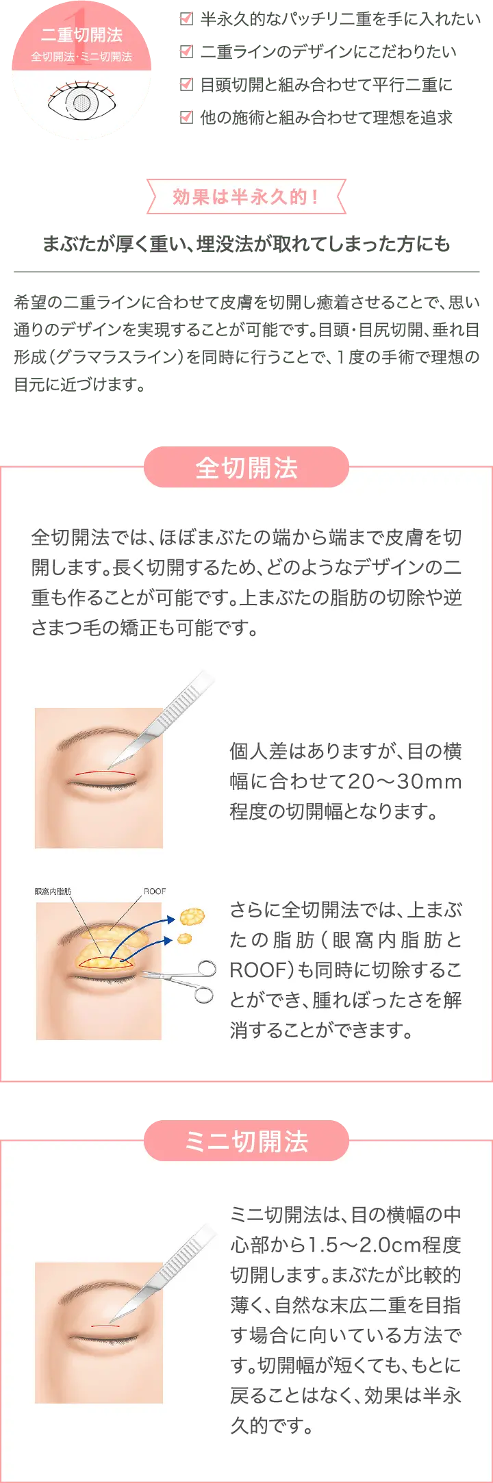 二重切開法のメリットを表した画像
