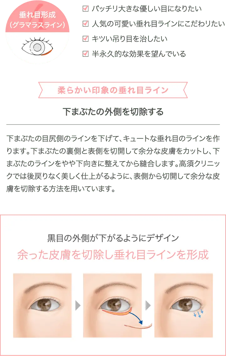 垂れ目形成のメリットを表した画像