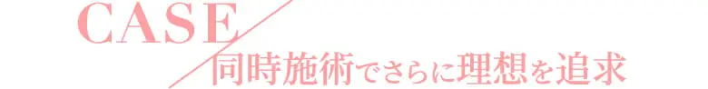 同時施術でさらに理想を追求