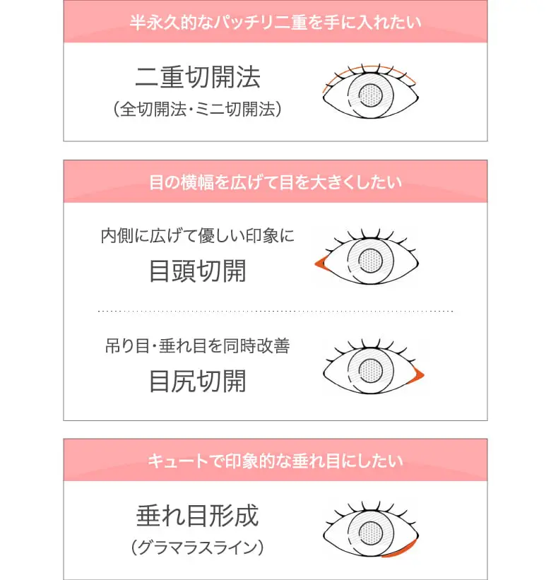 目元施術の種類を表した画像