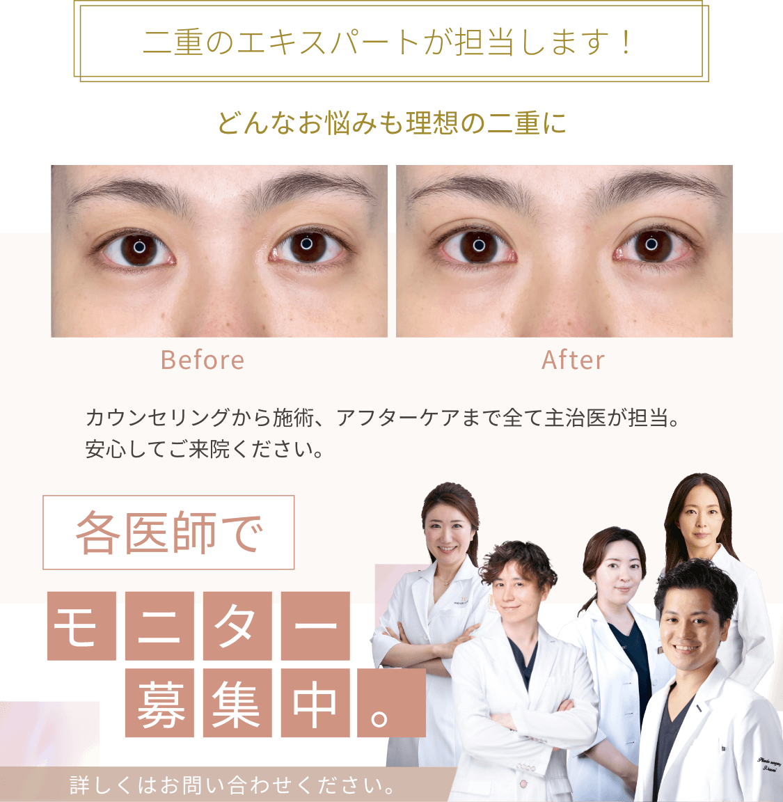 二重のエキスパートが担当します！どんなお悩みも理想の二重に　カウンセリングから施術、アフターケアまで全て主治医が担当。安心してご来院ください。各先生でモニター募集中。