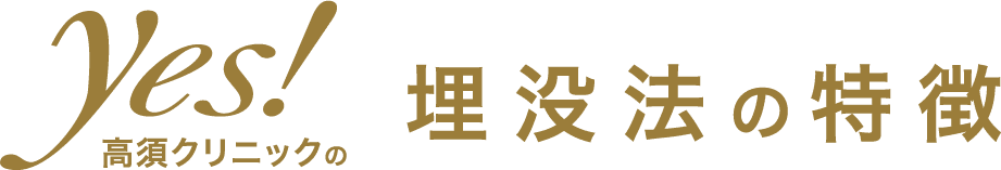 埋没法の特徴