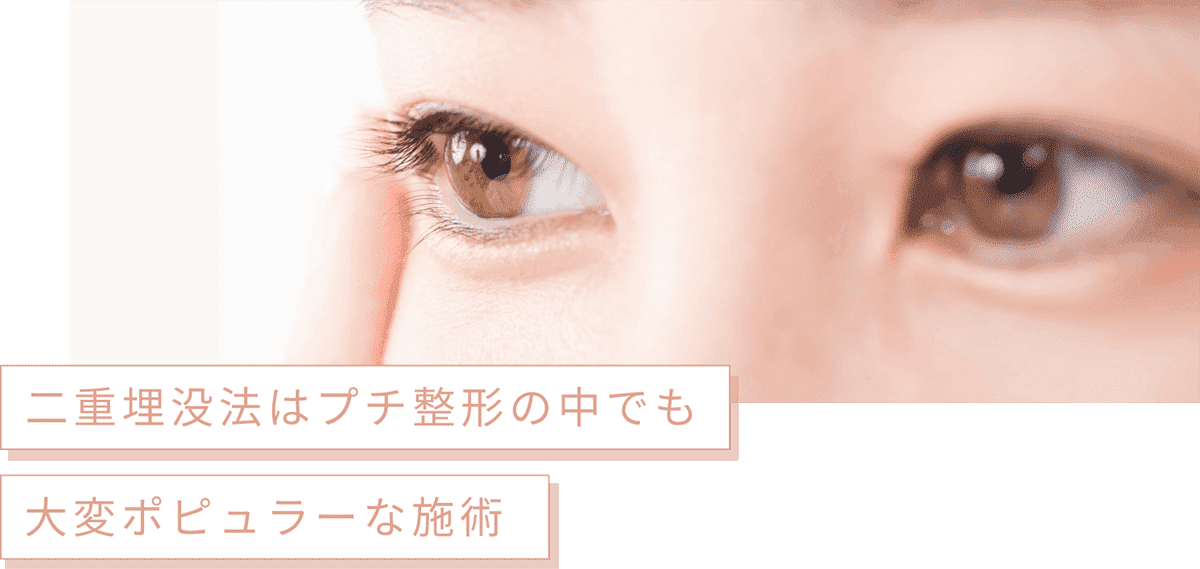 二重埋没法はプチ整形の中でも大変ポピュラーな施術