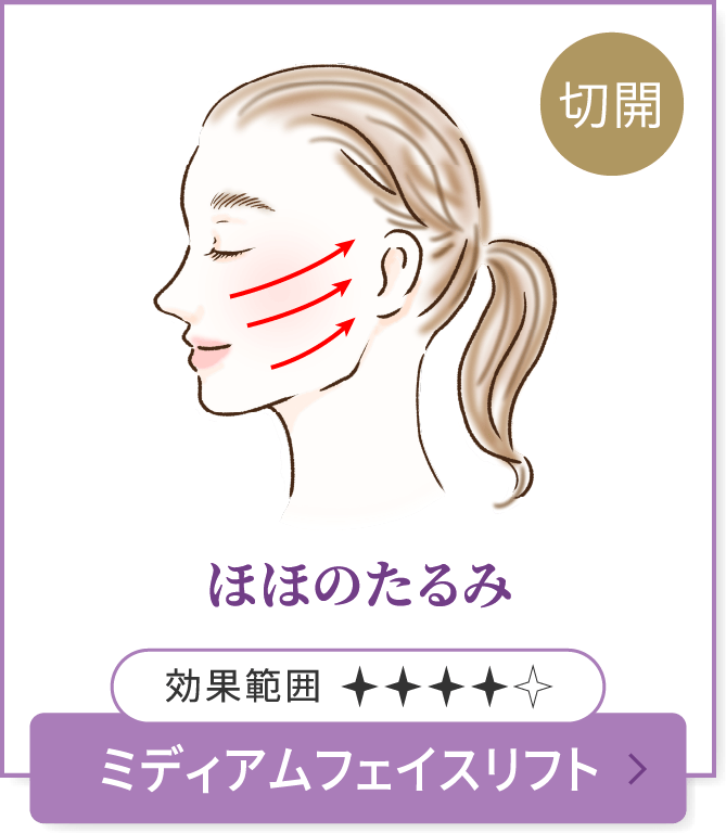 ほほのたるみ　ミディアムフェイスリフト