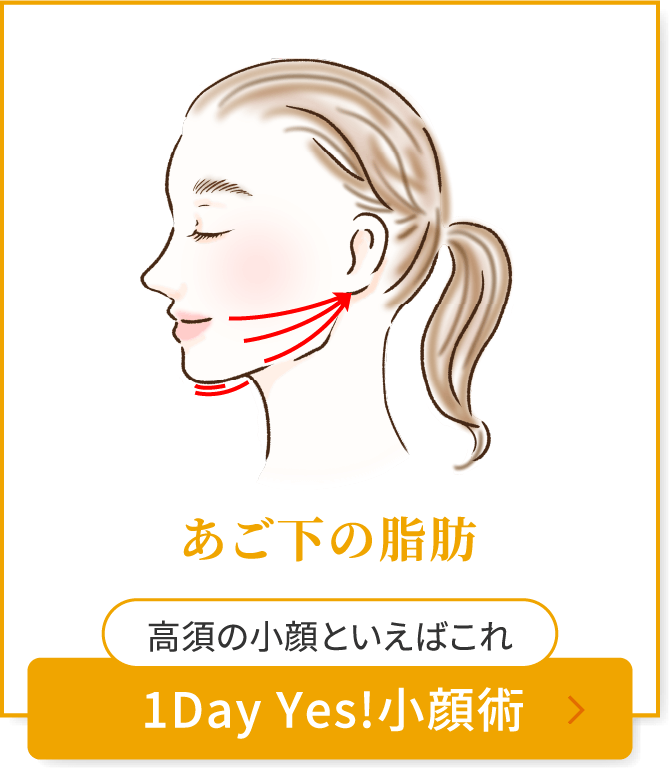 あご下の脂肪　1Day Yes!小顔術