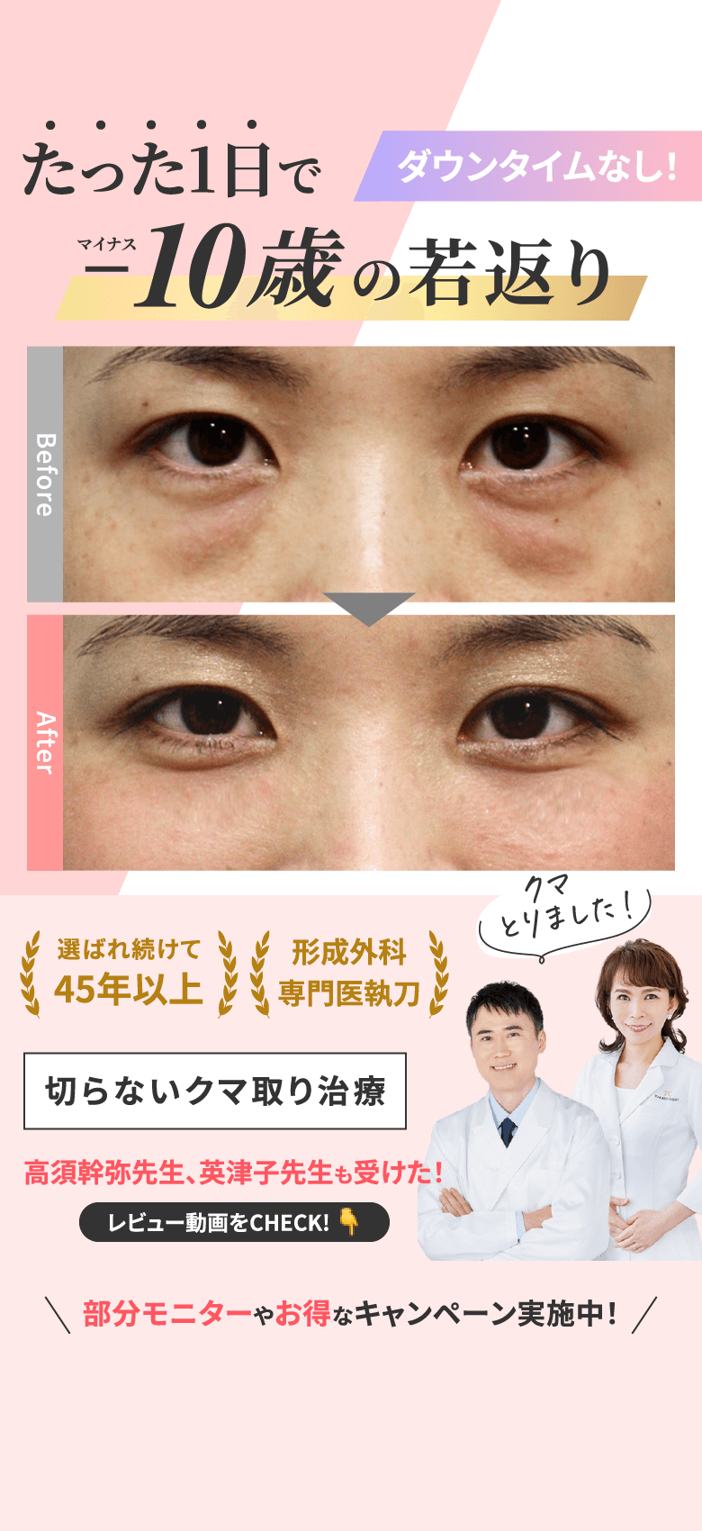 たった1日で-10歳の若返り