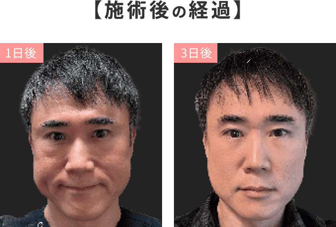 施術後の経過