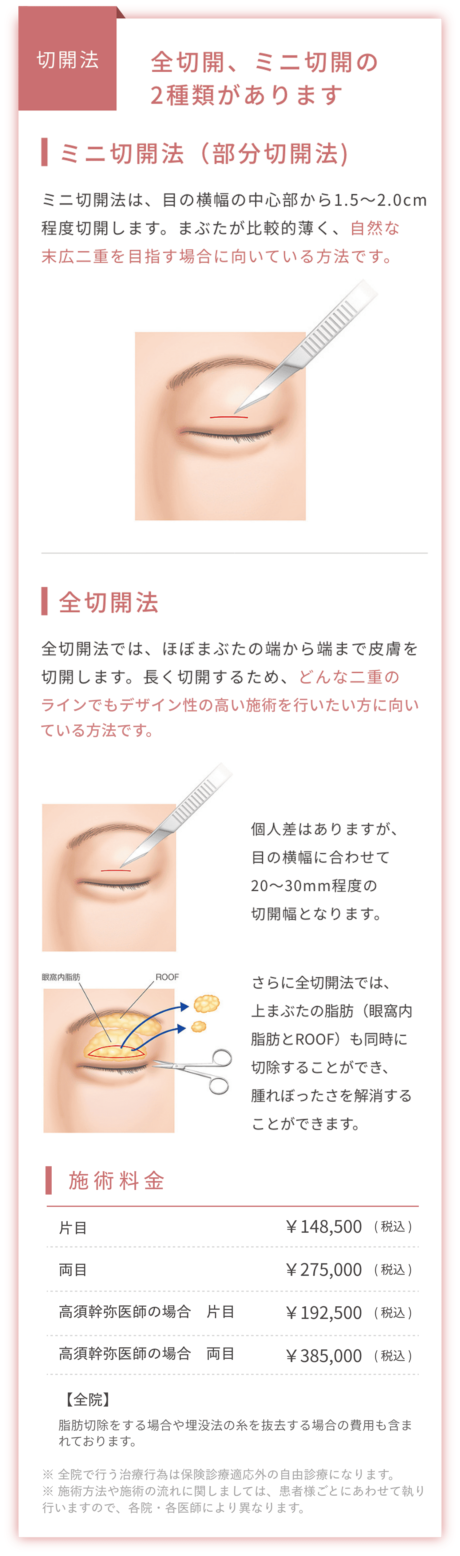 全切開、ミニ切開の2種類があります