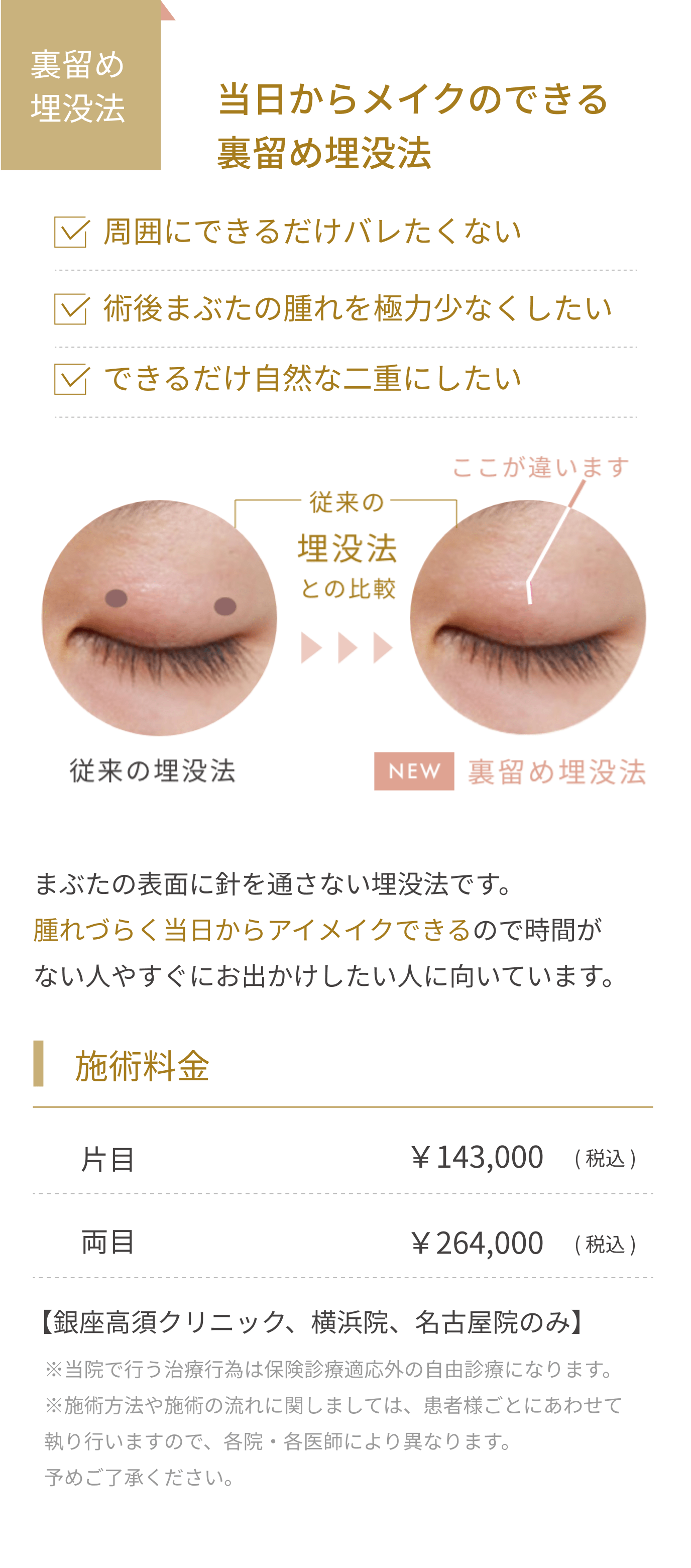 当日からメイクのできる裏留め埋没法