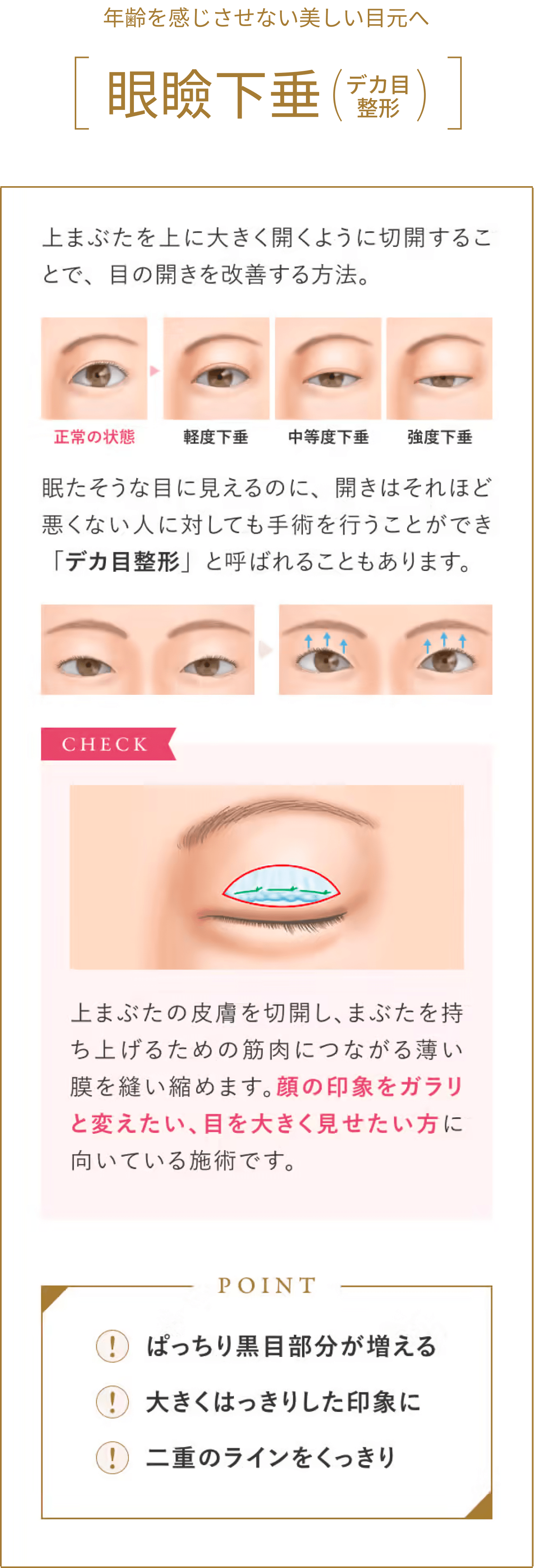 目元を若々しく