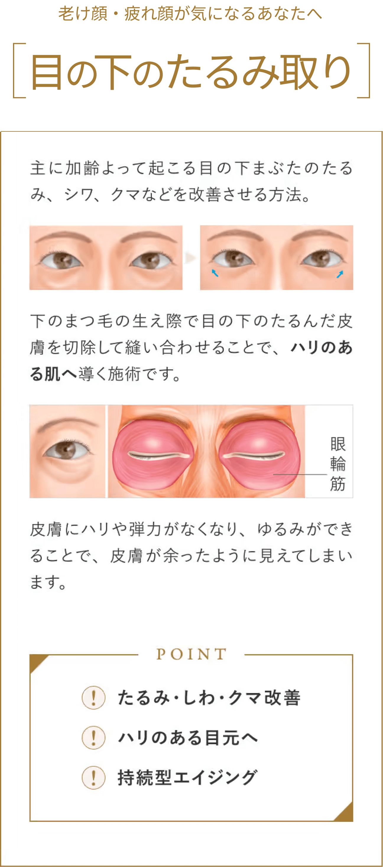 目の下のたるみ取り