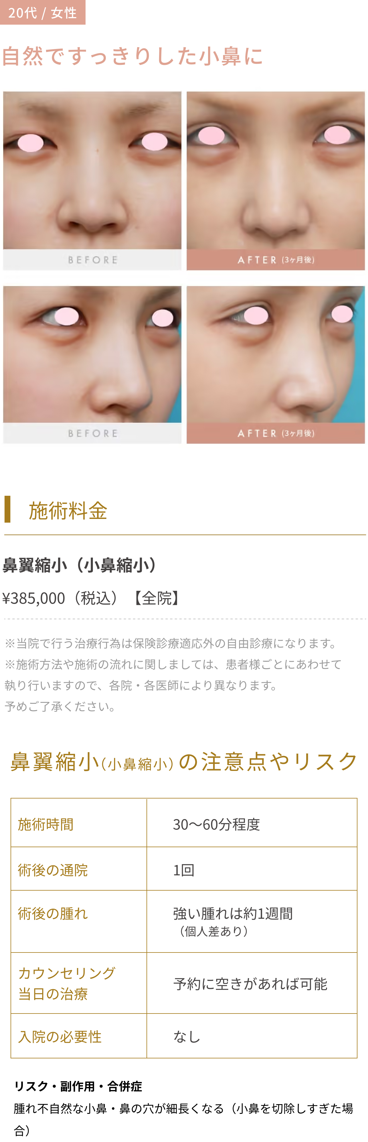 自然ですっきりした小鼻に