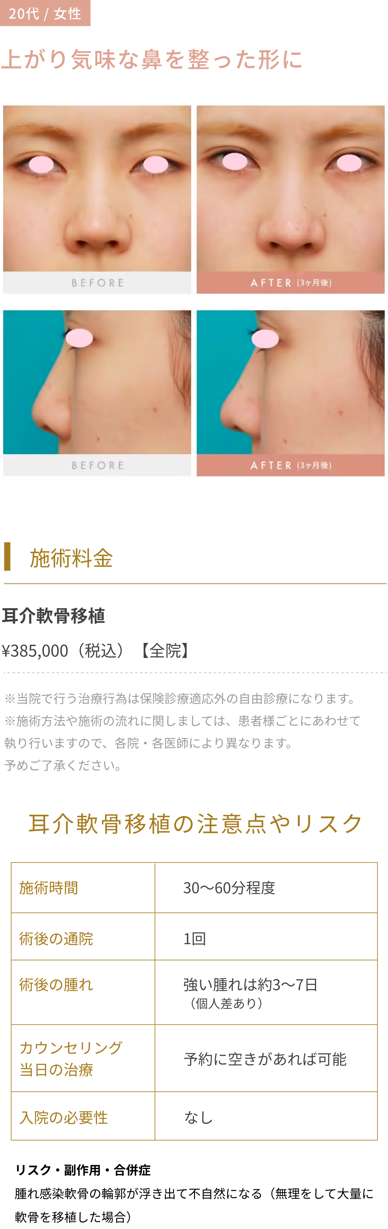 上がり気味な鼻を整った形に