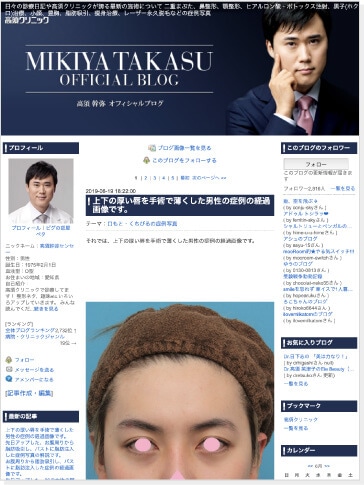 モニター募集 美容整形の高須クリニック 東京赤坂 横浜 名古屋 大阪 モニター募集 美容整形の高須クリニック 東京赤坂 横浜 名古屋 大阪