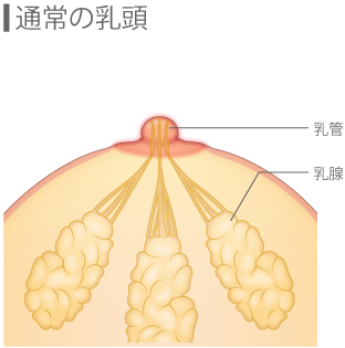 【通常の乳頭】
