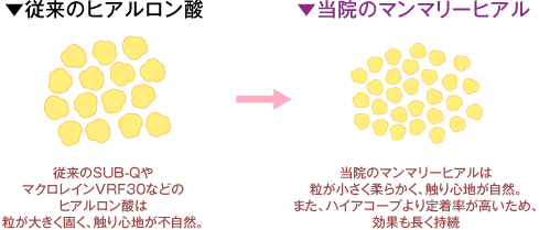 当院では使用していないヒアルロン酸→当院で使用しているヒアルロン酸