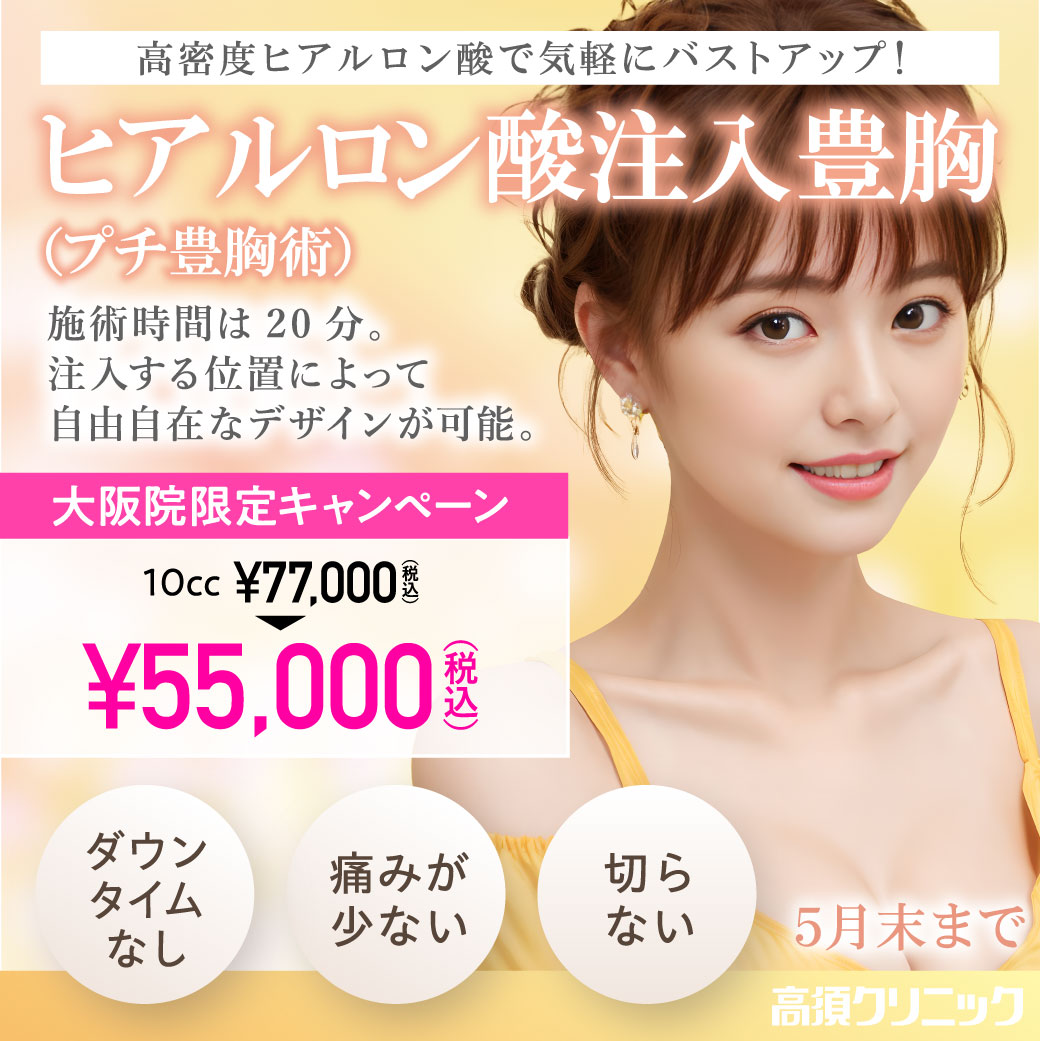 ヒアルロン酸注入豊胸（プチ豊胸術）/10cc 55,500円（税込）/大阪院限定/5月末まで