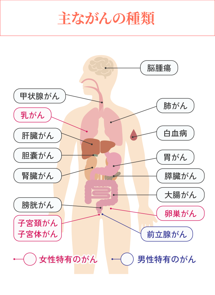 【主ながんの種類】甲状腺がん、肝臓がん、胆嚢がん、腎臓がん、膀胱がん、脳腫瘍、肺がん、白血病、胃がん、膵臓がん、大腸がん／＜女性特有のがん＞乳がん、子宮頸がん、子宮体がん、卵巣がん／＜男性特有のがん＞前立腺がん