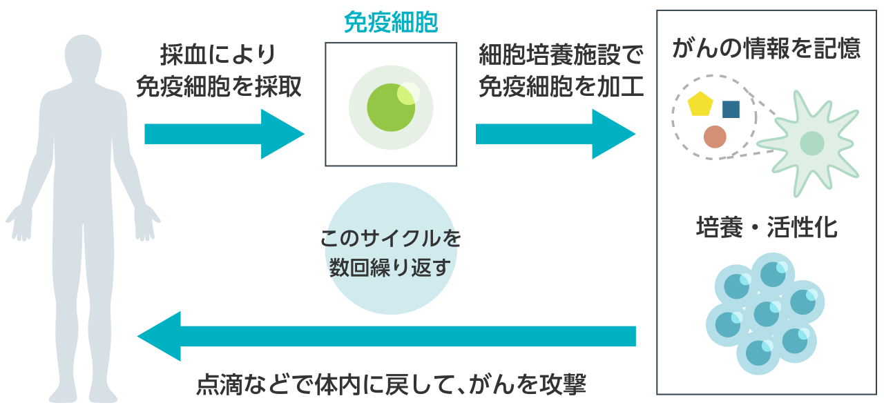 採血により免疫細胞を採取→【免疫細胞】→細胞培養施設で免疫細胞を加工→がんの情報を記憶（培養・活性化）→点滴などで体内に戻して、がんを攻撃／このサイクルを数回繰り返す