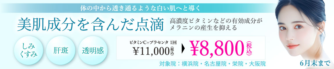美肌成分を含んだ点滴 キャンペーン