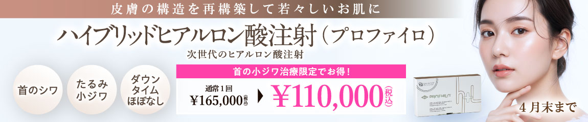 ハイブリッドヒアルロン酸注射 キャンペーン/全院対象/4月末まで