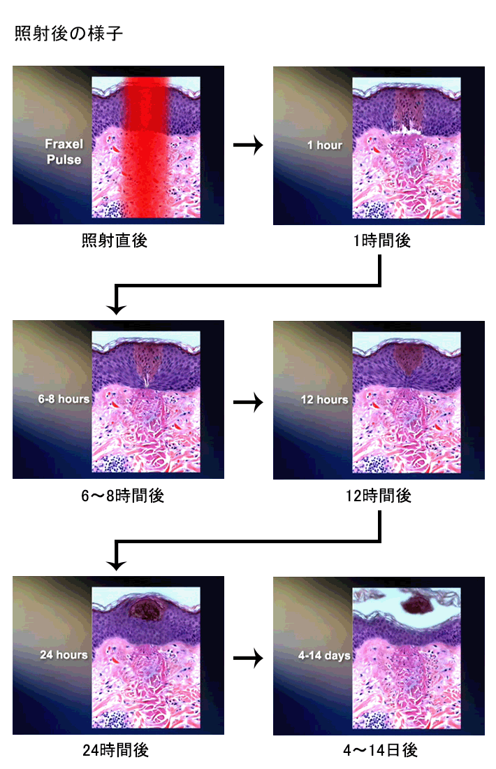 照射後の様子