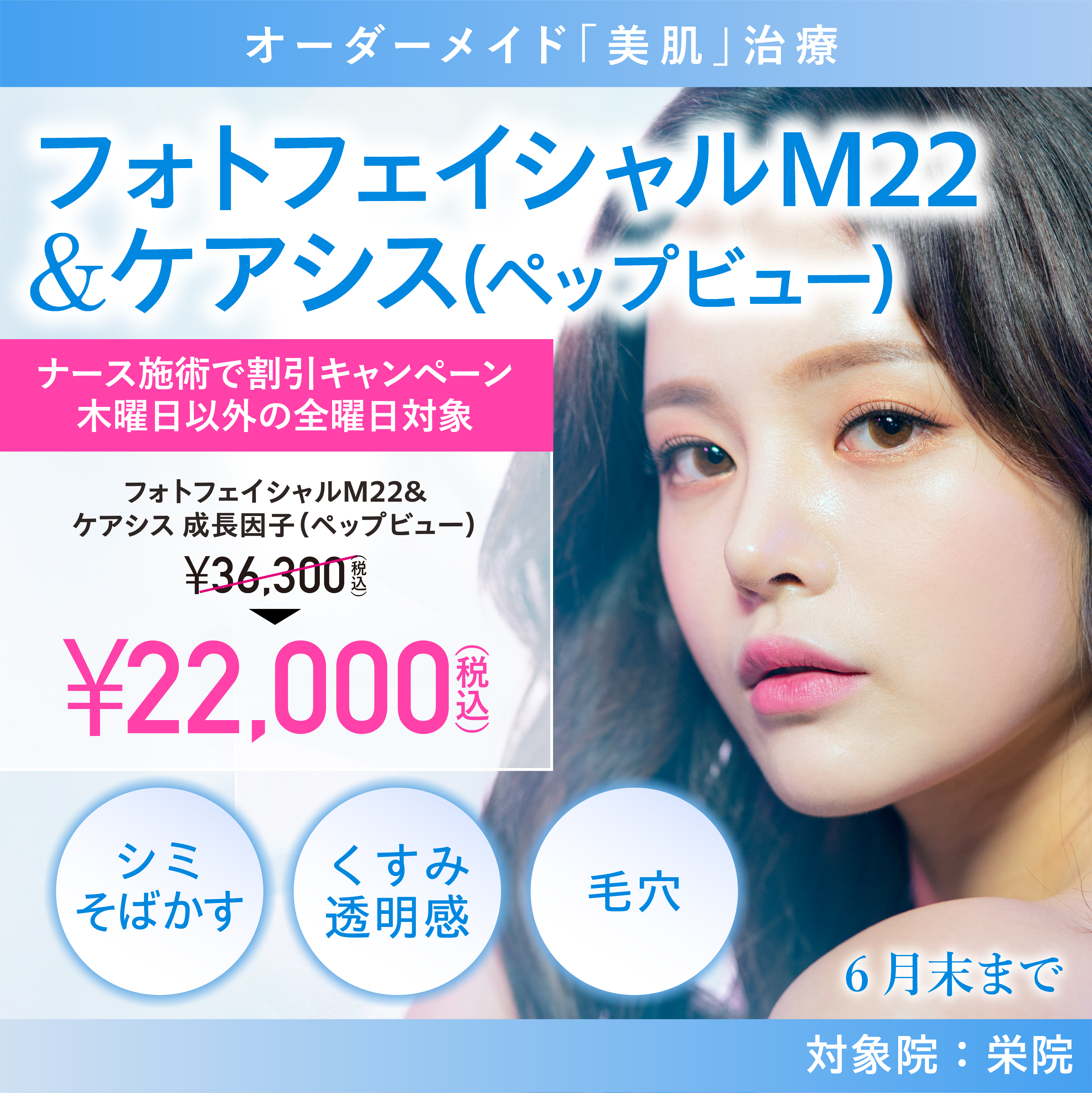 フォトフェイシャルM22&ケアシス（ペップビュー）キャンペーン/59,400円（税込）/横浜院、名古屋院/3月末まで