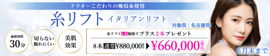 糸リフト(イタリアンリフト)キャンペーン/6本施術で2本プレゼント 8本660,000円/名古屋院限定/6月末まで
