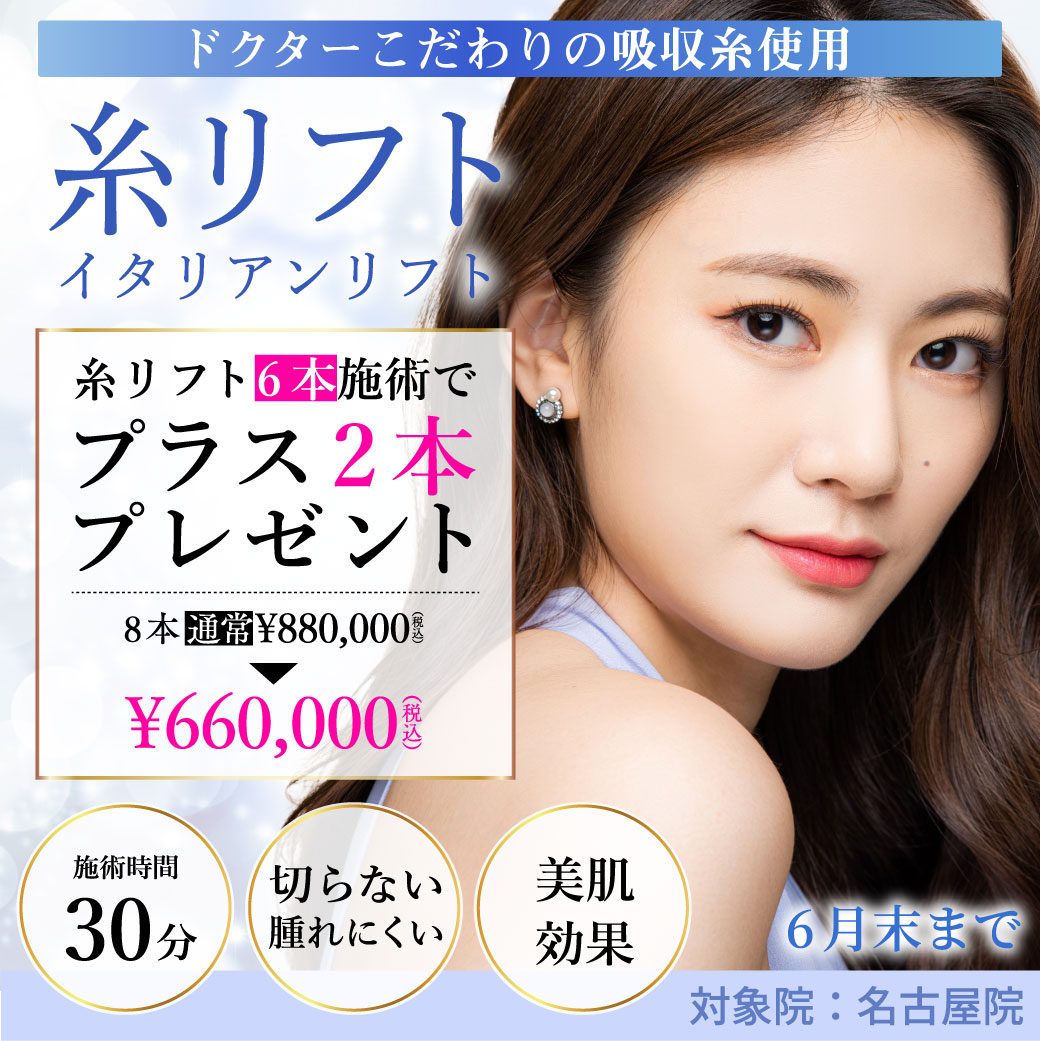 糸リフト(イタリアンリフト)キャンペーン/6本施術で2本プレゼント 8本660,000円/名古屋院限定/6月末まで