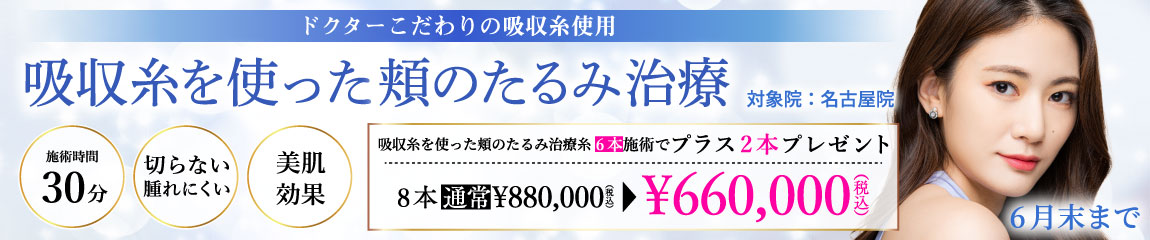 吸収糸を使った頬のたるみ治療 キャンペーン/6本施術で2本プレゼント 8本660,000円/名古屋院限定/6月末まで