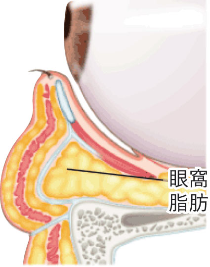 眼窩脂肪