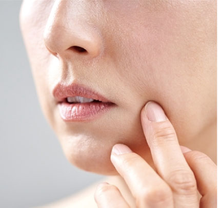 口横の「ぽにょ」