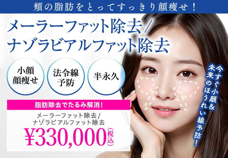 メーラーファット除去/ナゾラビアルファット除去