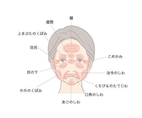図1:効果的なパーツ