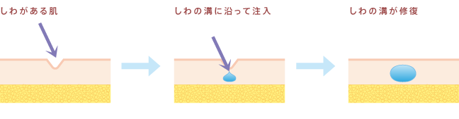 図1:ヒアルロン酸とは?