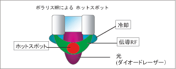 ポラリス