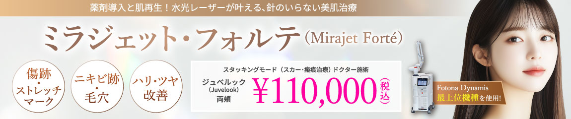 ミラジェット・フォルテ（Mirajet Forte）