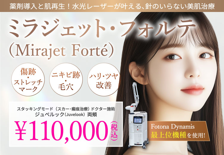 ミラジェット・フォルテ（Mirajet Forte）