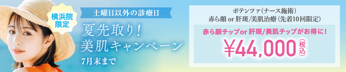 夏先取り!美肌キャンペーン/赤ら顔チップor肝斑・美肌チップがお得に!¥44,000(税込)/横浜院限定/7月末まで